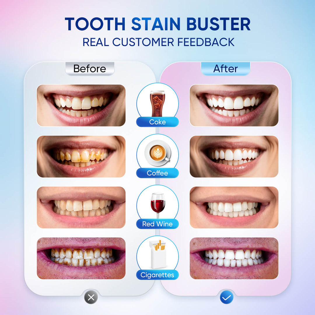 BodyAccel Dentifrice Blanchissant au Niacinamide